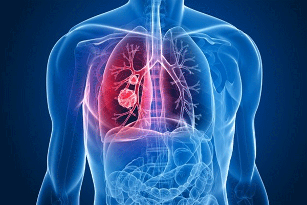 LUNGS