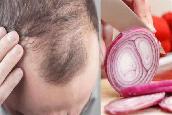 onion
