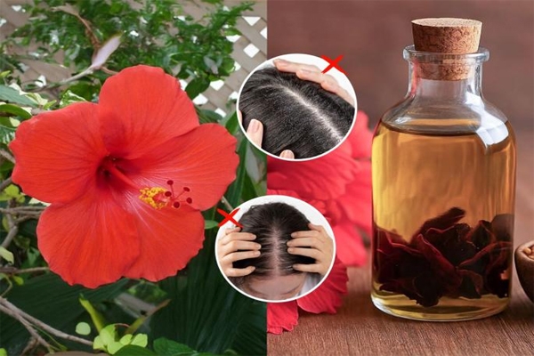 hibiscus hair oil