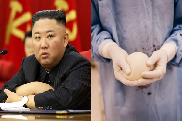 North Korea breast surgery