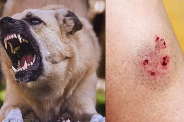die-due-to-dog-bite die-due-to-dog-bite