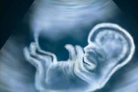 चक्क चारचाकी वाहनात सुरू होते गर्भलिंग निदान