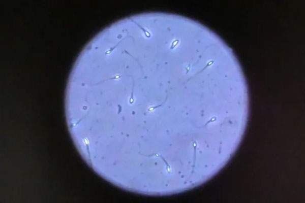 Chinese research on male fertility Chinese research on male fertility