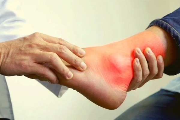 युरिक ऍसिड 