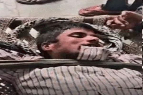 dog-bite-viral-video