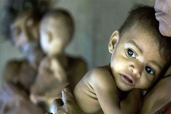  maharashtra child malnutrition