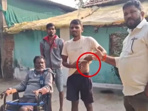 chandrapur-kidney-farmer