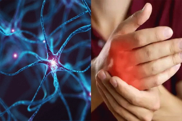 Guillain-Barré syndrome patients Guillain-Barré syndrome patients