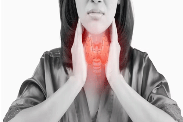 Thyroid symptoms