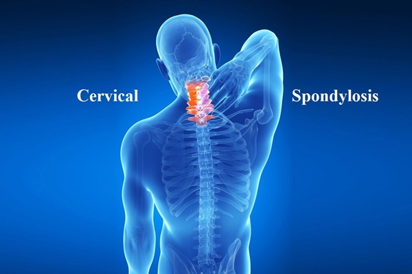 cervical 