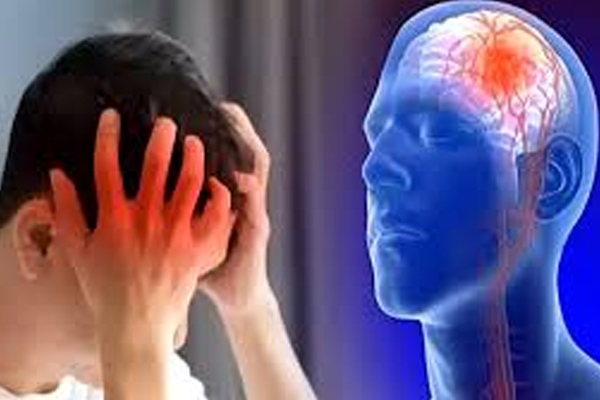 brain stroke
