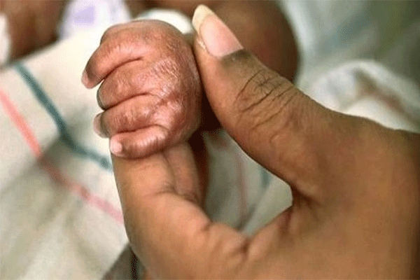 baby-slipped-from-and-fell-into-fire