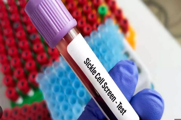 arunoday-sickle-cell-campaign