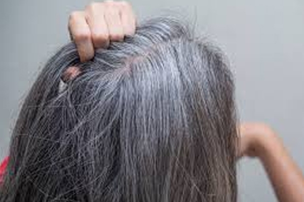 gray hair