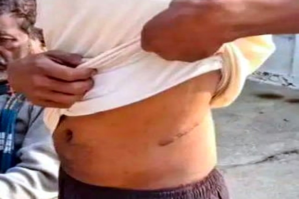 kidney-selling-racket-case