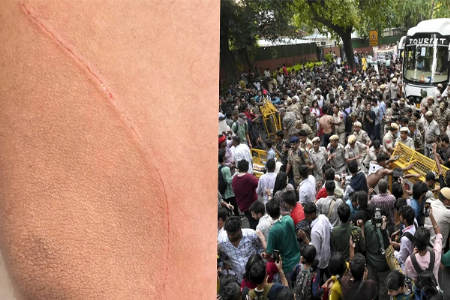 आंदोलनाचा सूर बदलला! जवानावर वार