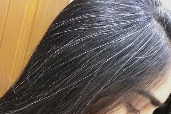 gray prematurely hair 