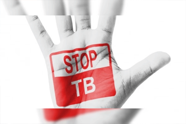 TB FREE