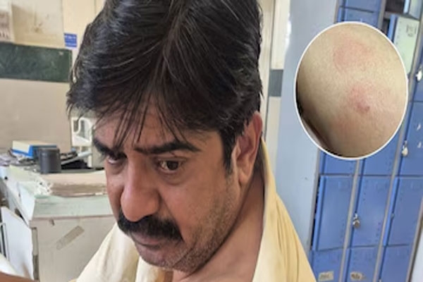 Ramesh Pardeshi dog bite incident