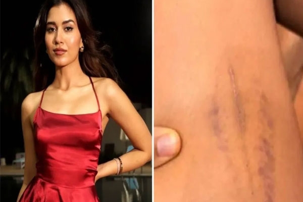  Splitsvilla controversy