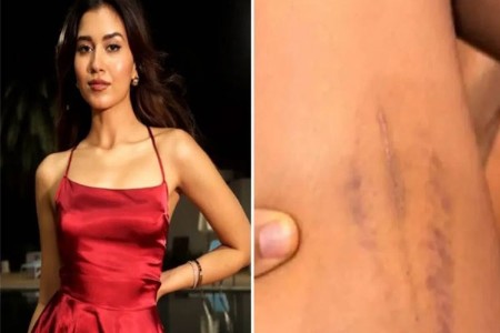 अबब...हिलच्या सँडलने मारहाण