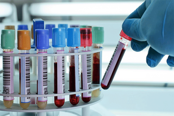 Mahalab project closed