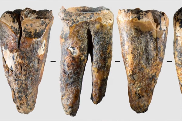 Root Canals
