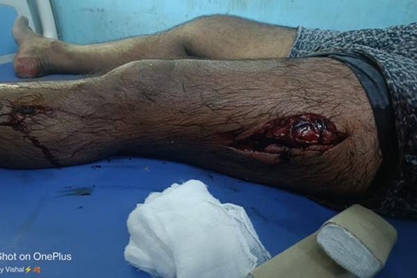 injured in wild boar attack