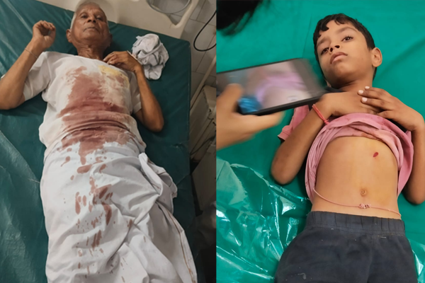 घरात घुसून चिमुकल्यासह आजोबांवर प्राणघातक हल्ला
