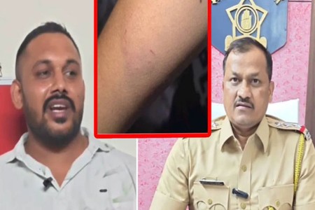 तिसरीतील विद्यार्थ्याचा हात चावला शिक्षकाचा भयंकर प्रताप