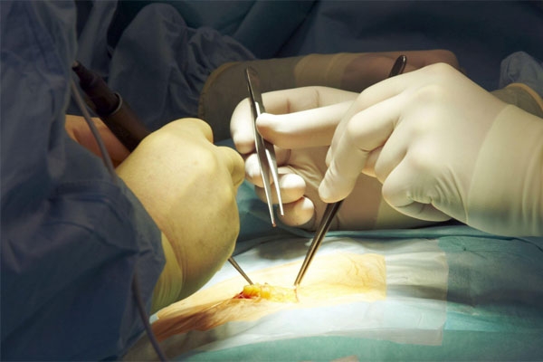 rare surgery